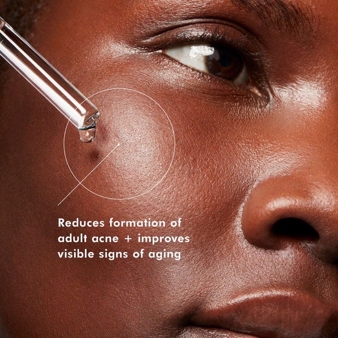 SkinCeutical Blemish & Age Defense Serum for Oily & Acne Skin 30ml