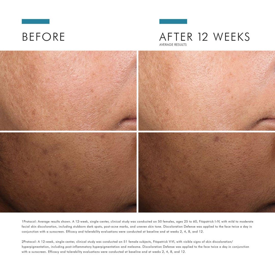 SkinCeuticals Discoloration Defense 5% Niancinamide Serum for Uneven Skin 30ml