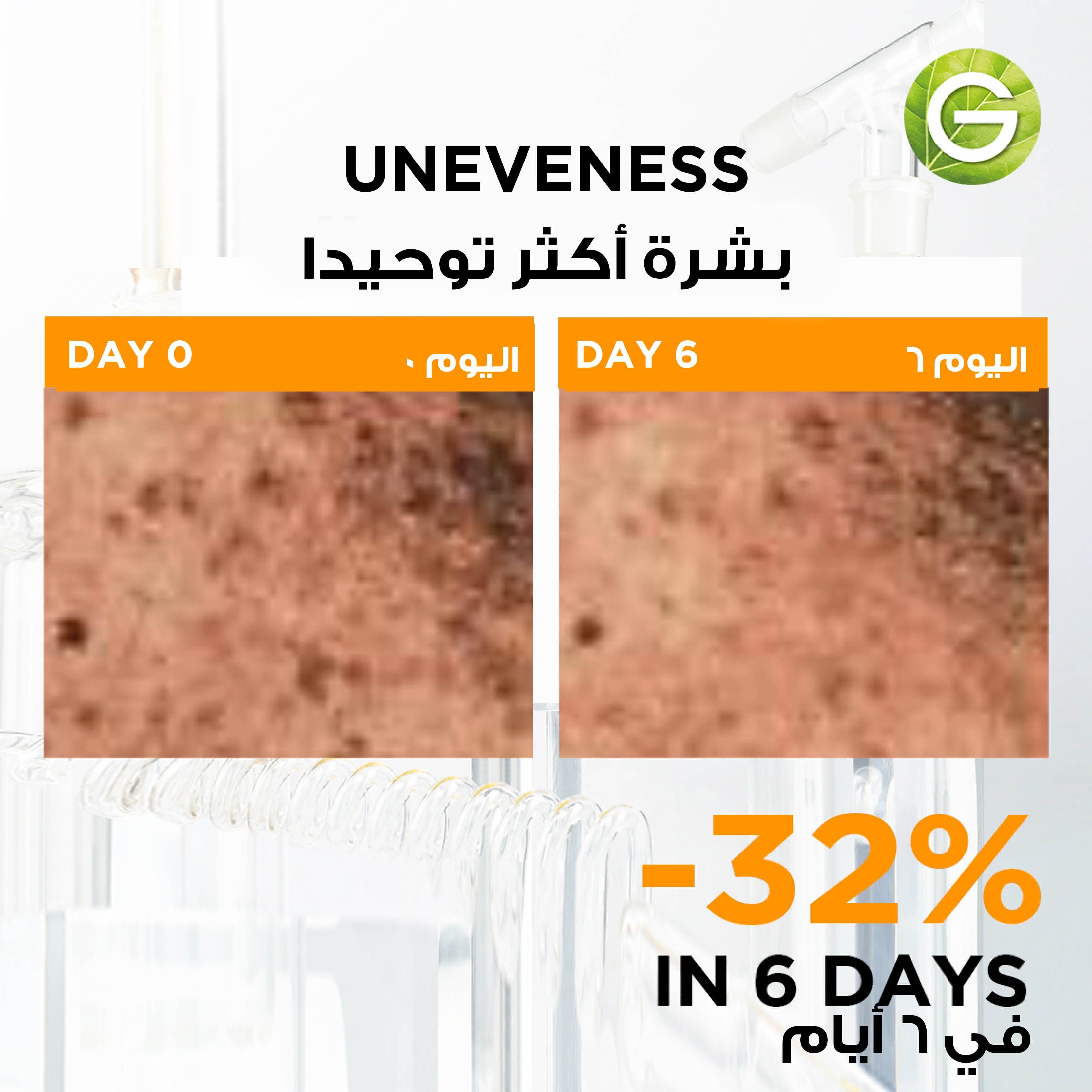 Garnier Skin Active Fast Bright 3% Vitamin C & Niacinamide Serum 1 Ampoule 1.5 ml