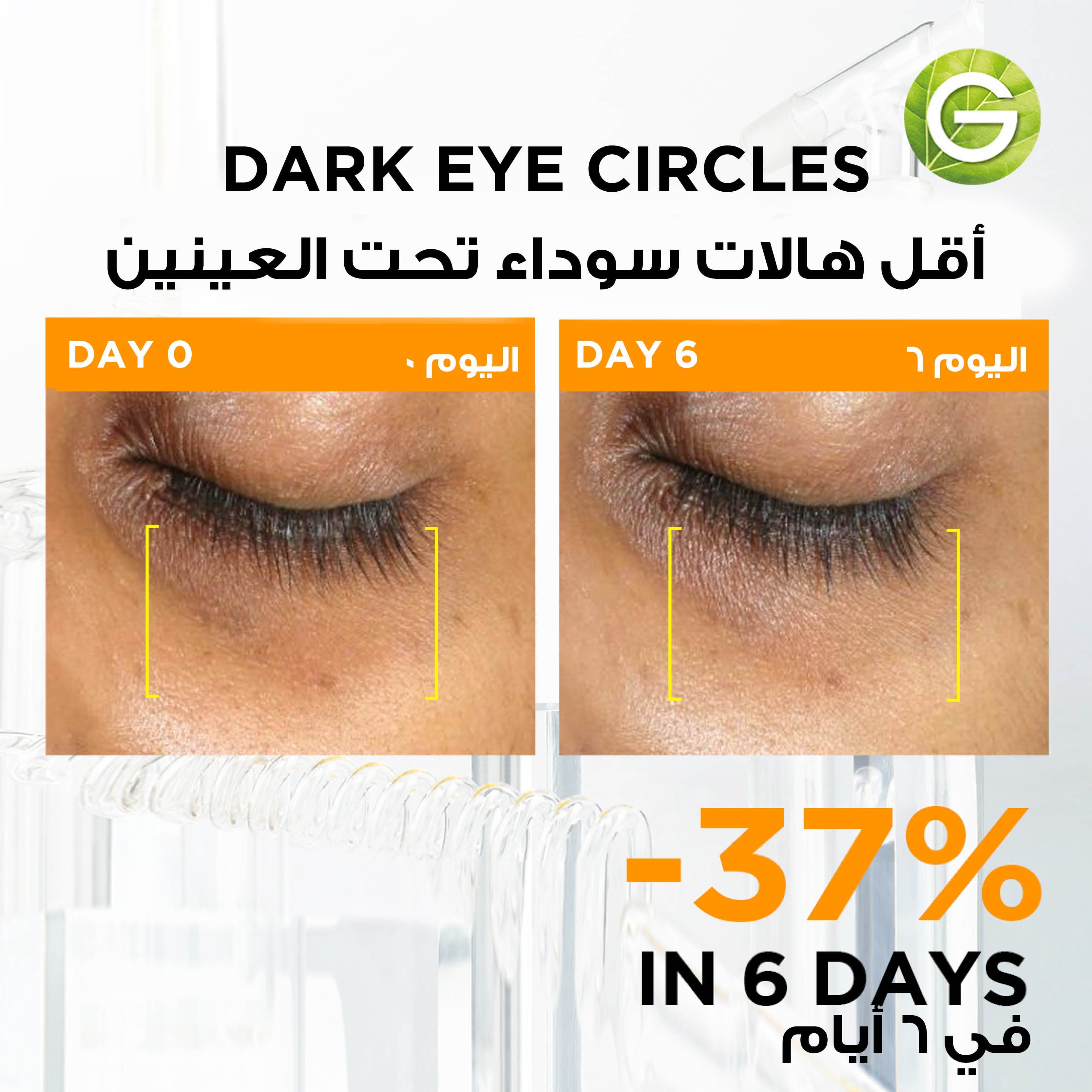 Garnier Skin Active Fast Bright 3% Vitamin C & Niacinamide Serum 1 Ampoule 1.5 ml