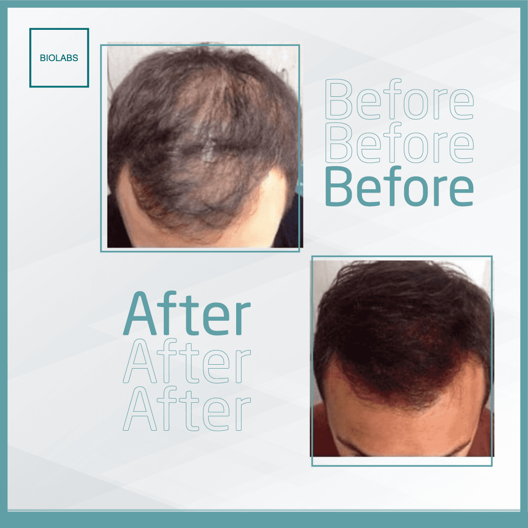 Biolabs Hair Growth Serum Men 50 Ml