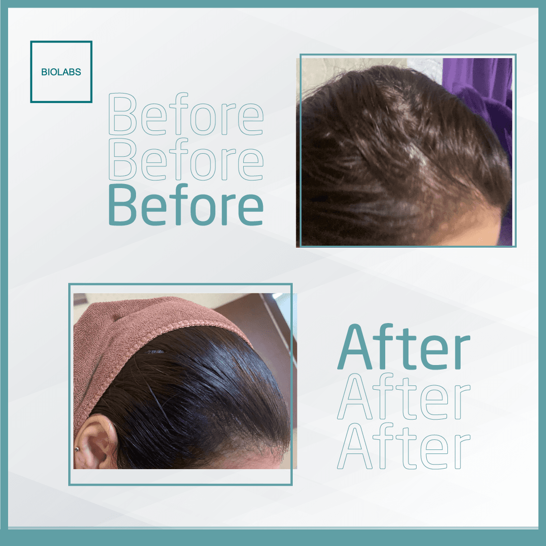 Biolabs Womens Hair Care Set