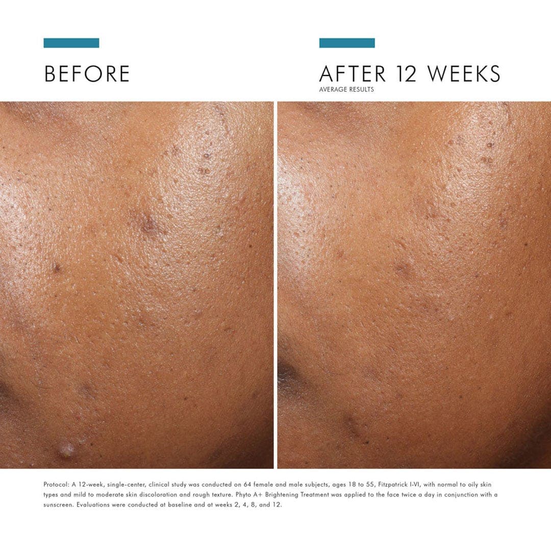 Skinceuticals Phyto A+ Brightening Treatment 30ml