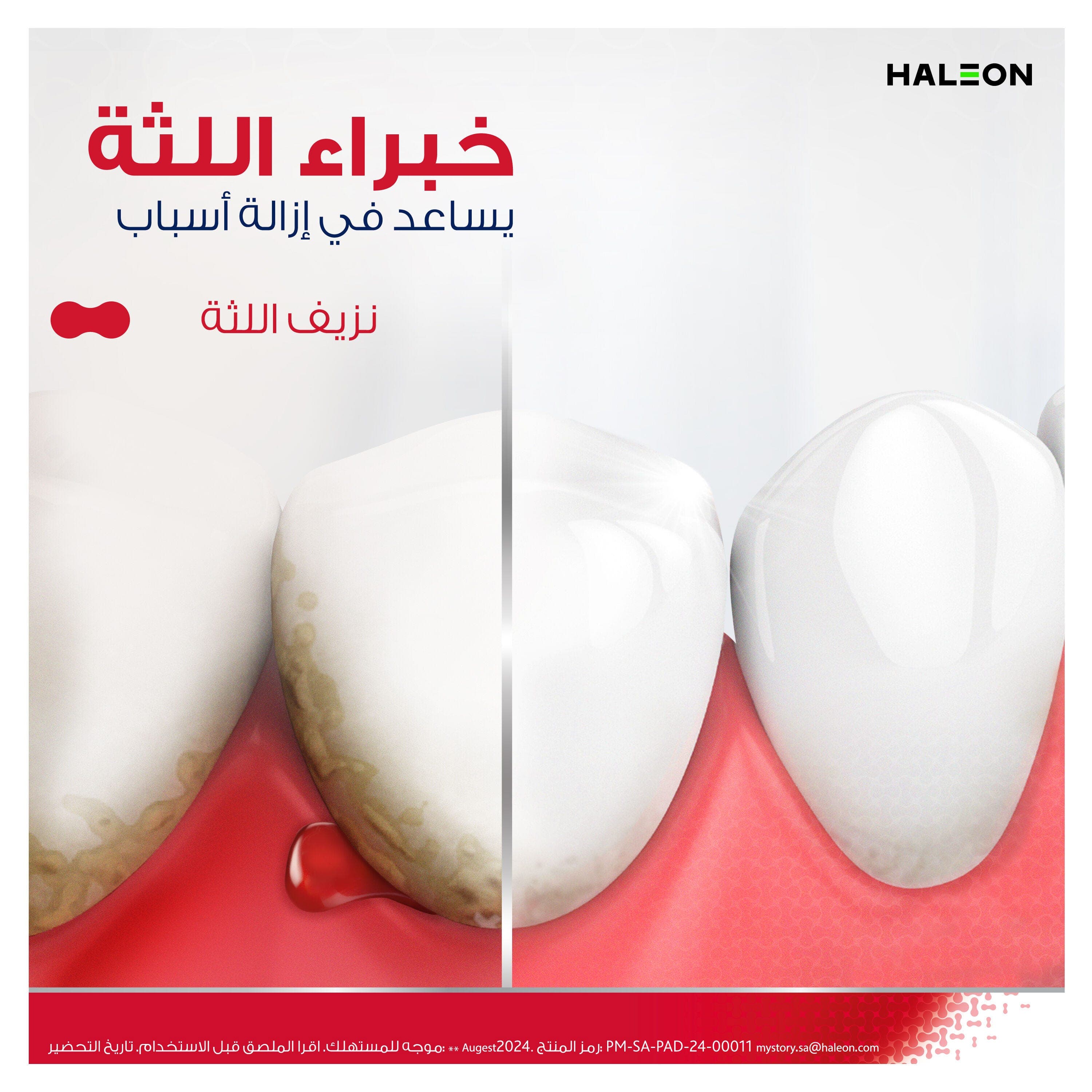 بارودونتكس معجون اسنان ترميم فعال للثة نعناع منعش 75 ملى