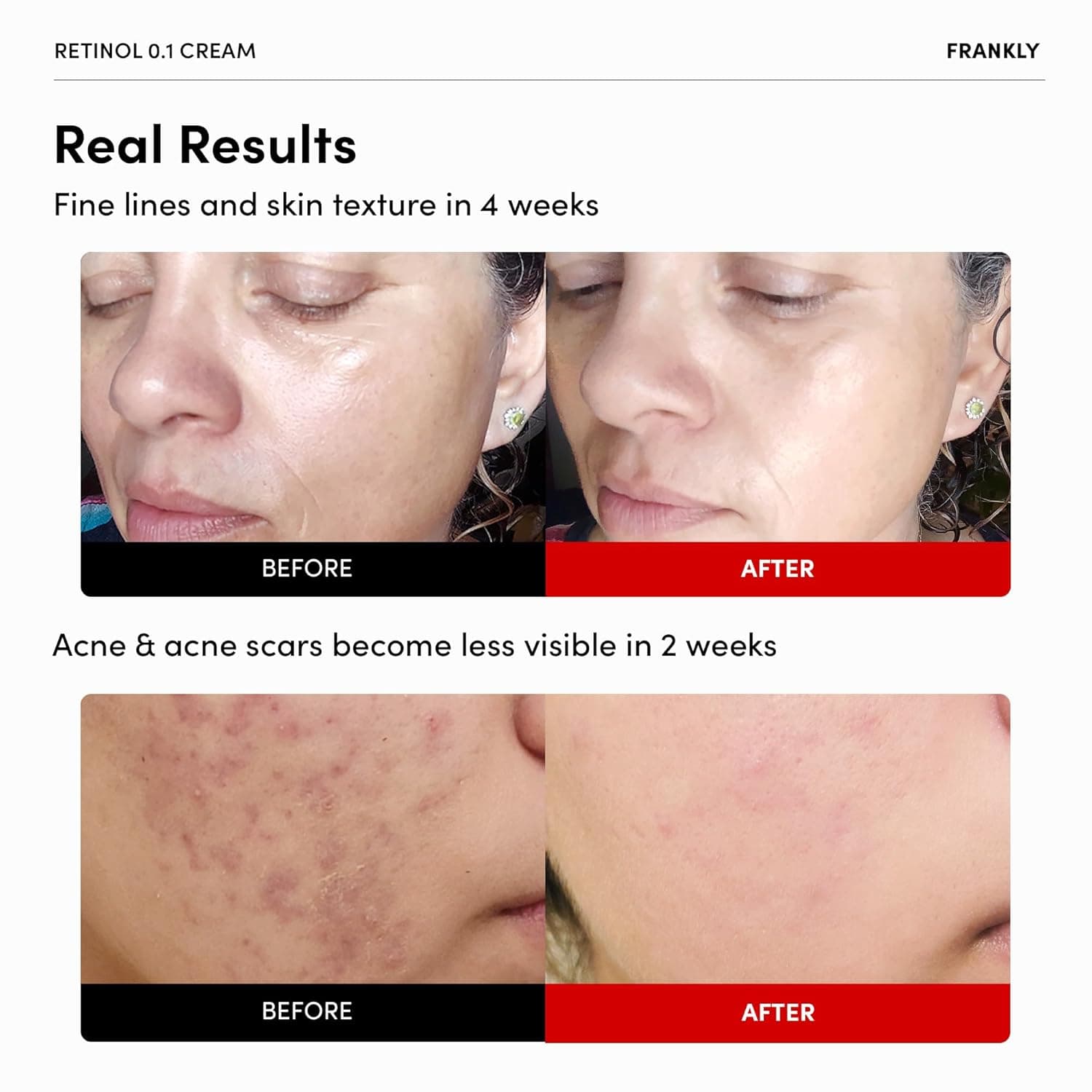 Frankly Retinol Cream 0.3 20ml