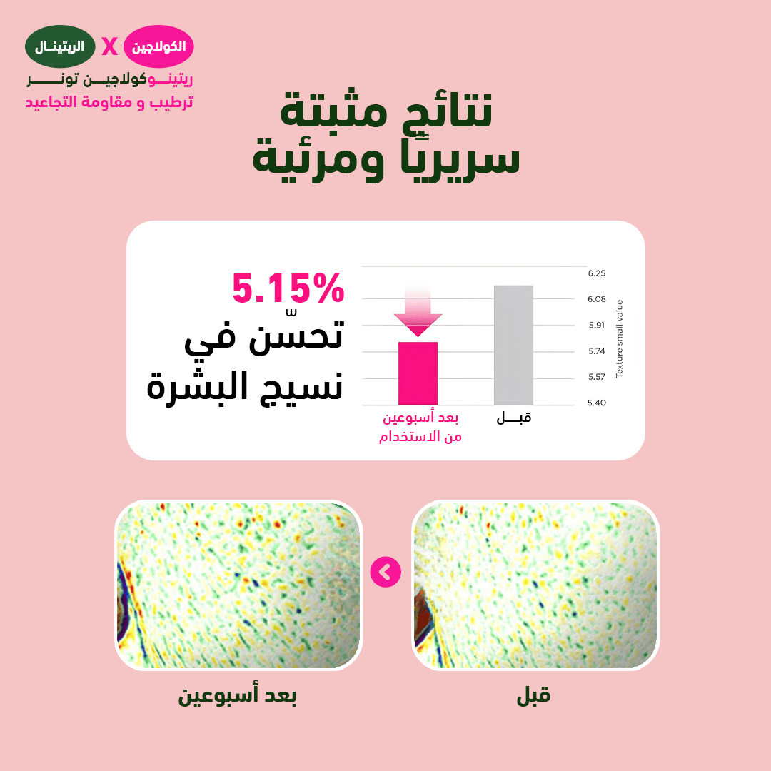 سي كي دي ريتينو كولاجين صغير الجزيئات 300 دالتون تونر للبشرة - 250 مل
