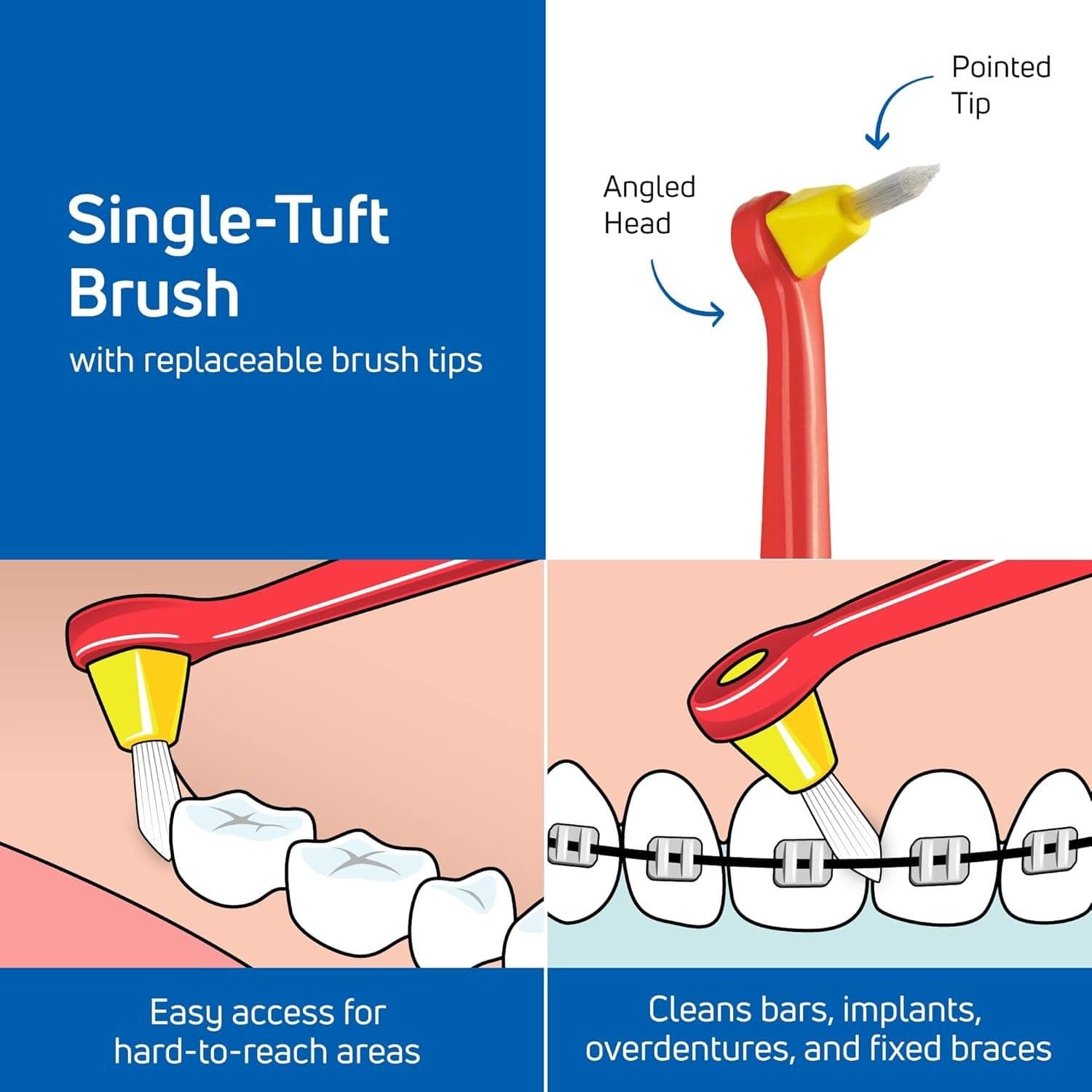Tepe Soft Tb Last Molar, Gum Pockets With 12 Heads