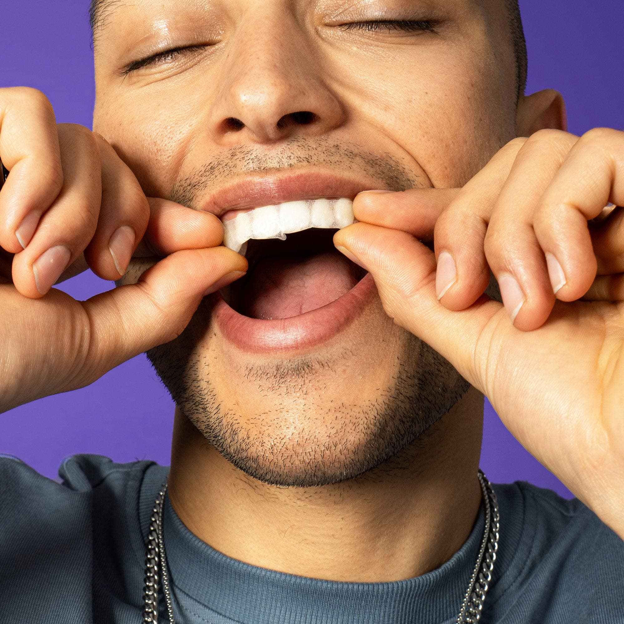 Smilepen Power Whitening Strips (14x2)
