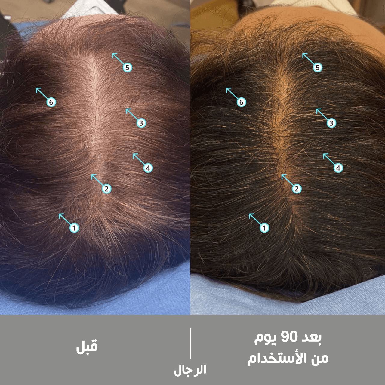 سبيكتـرال عالي القوة ضد الشيب + سيروم كثافة الشعر 60 مل