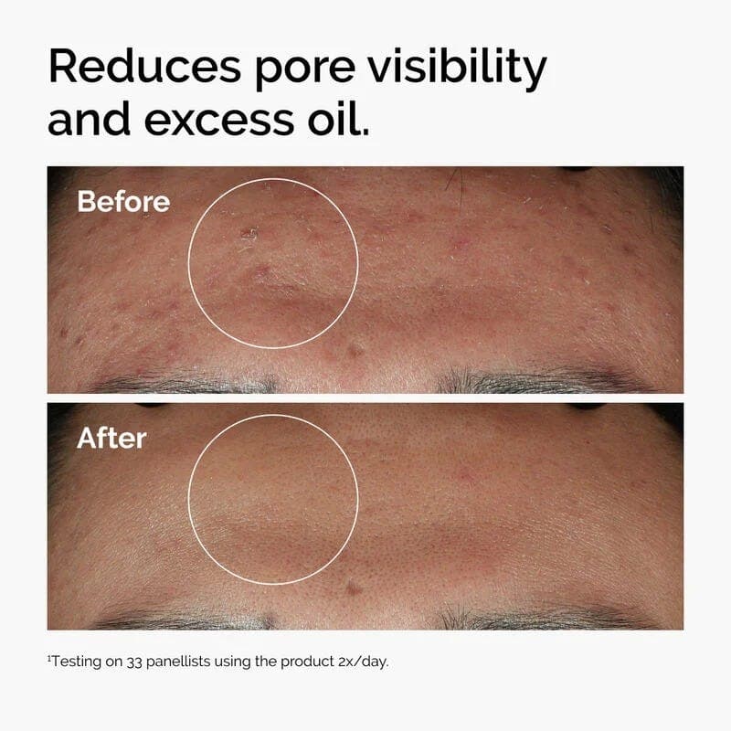 The Ordinary Niacinamide 10% + Zinc 1% - 60 ml