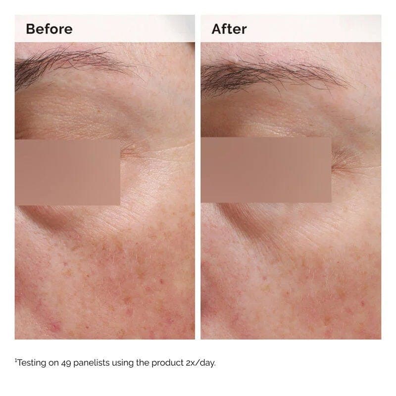 The Ordinary Niacinamide 5% Face & Body Emulsion - 100 ml