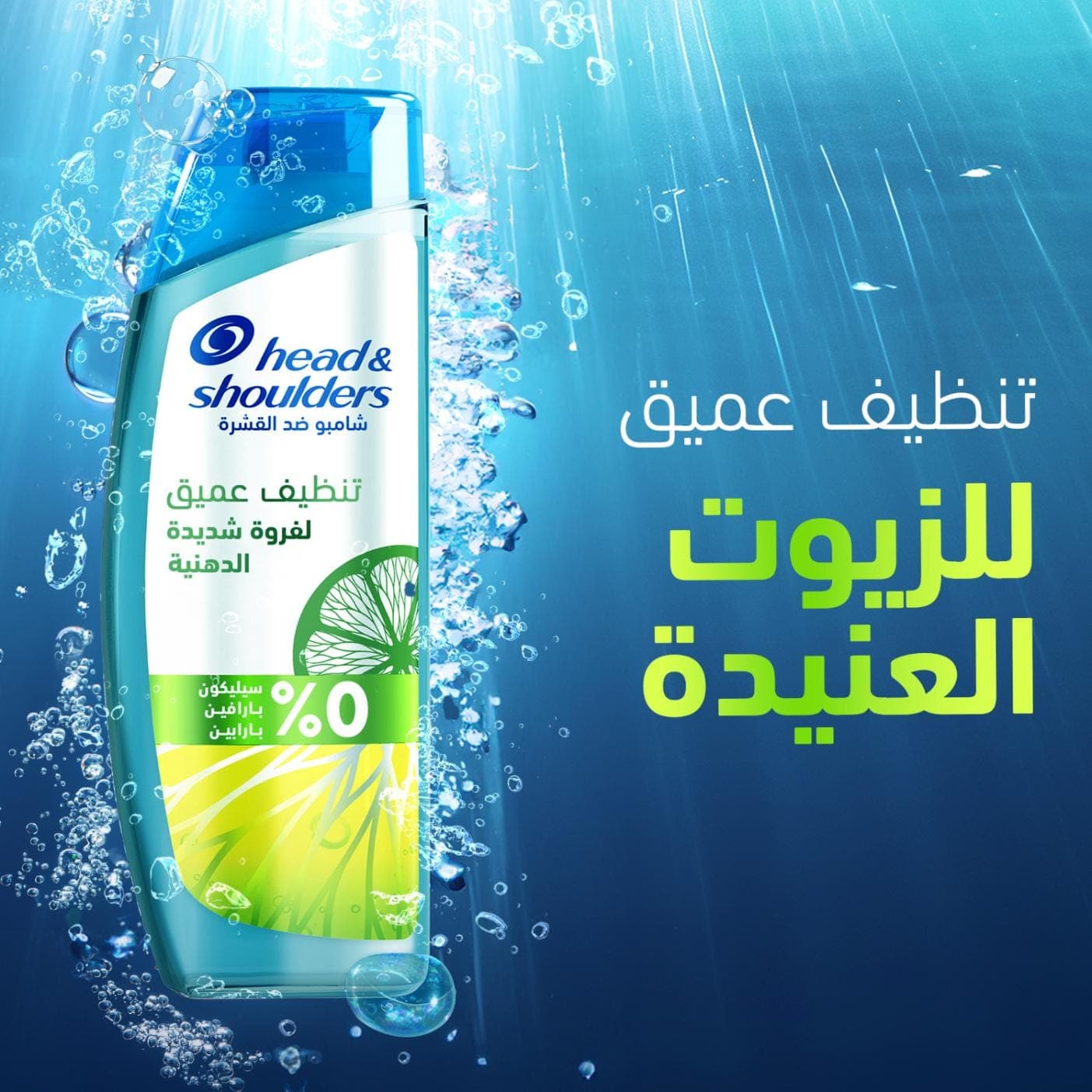 Head & Shoulders Deep Clean Anti-Dandruff Shampoo – Severe Oil Control, Deep Cleansing, 300ml